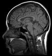 brain image NIH mri